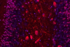 Nissl bodies amd PTEN negative cells in the hippocampus