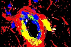 eNOS around arteriole in olfactory bulb: animal model of neurodegeneration