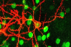 Rat Dorsal Striatum Medium Spiny Neuron