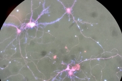 Neurons are your inner galaxy