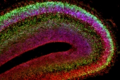 Developing layers of the E17 mouse cortex