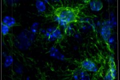 IL-4 stimulated microglia in mouse striatum
