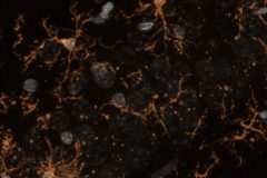 Microglial cells at Rat Hippocampus