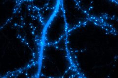 Synapses in the dendritic tree