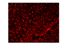 TSPO positive Micoglial cells in Hippocampus